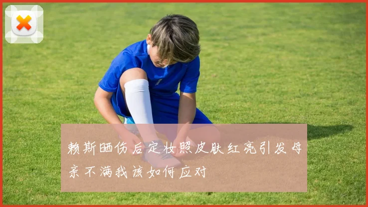 赖斯晒伤后定妆照皮肤红亮引发母亲不满我该如何应对